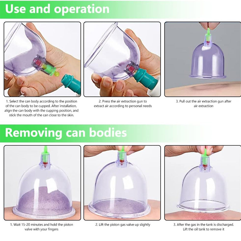Vacuum Cupping Device